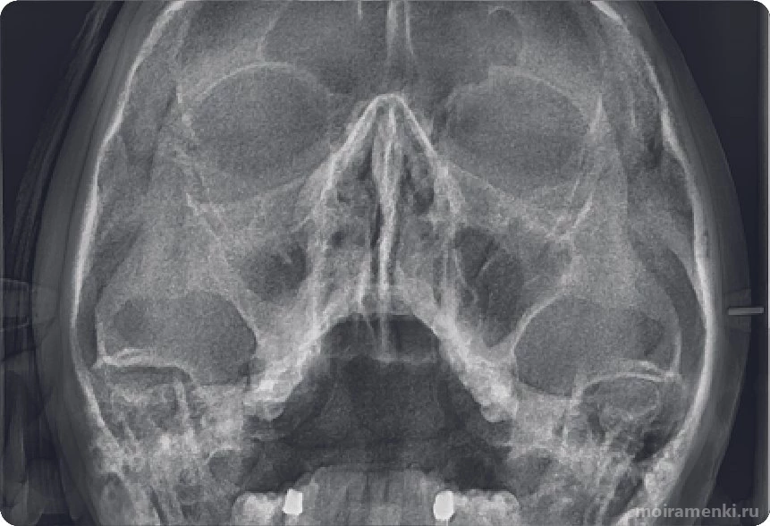 Центр диагностики челюстно-лицевой области Пикассо на Мичуринском проспекте Изображение 7
