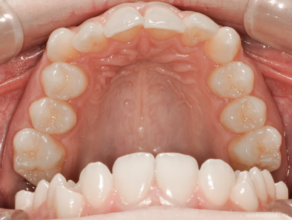 Клиника функциональной стоматологии доктора Кочкарова Изображение 2