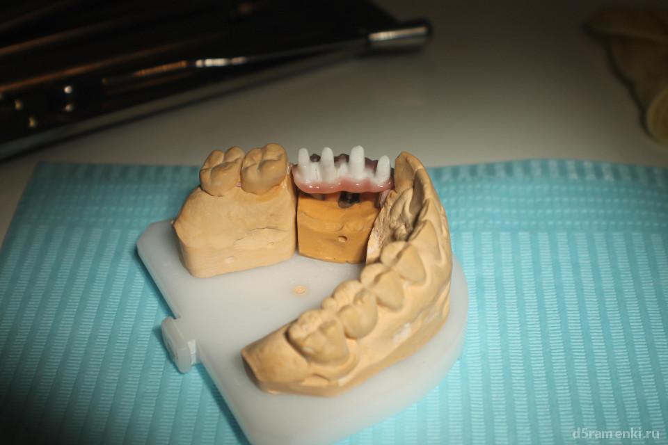 Стоматологическая клиника Zeta dent Изображение 3